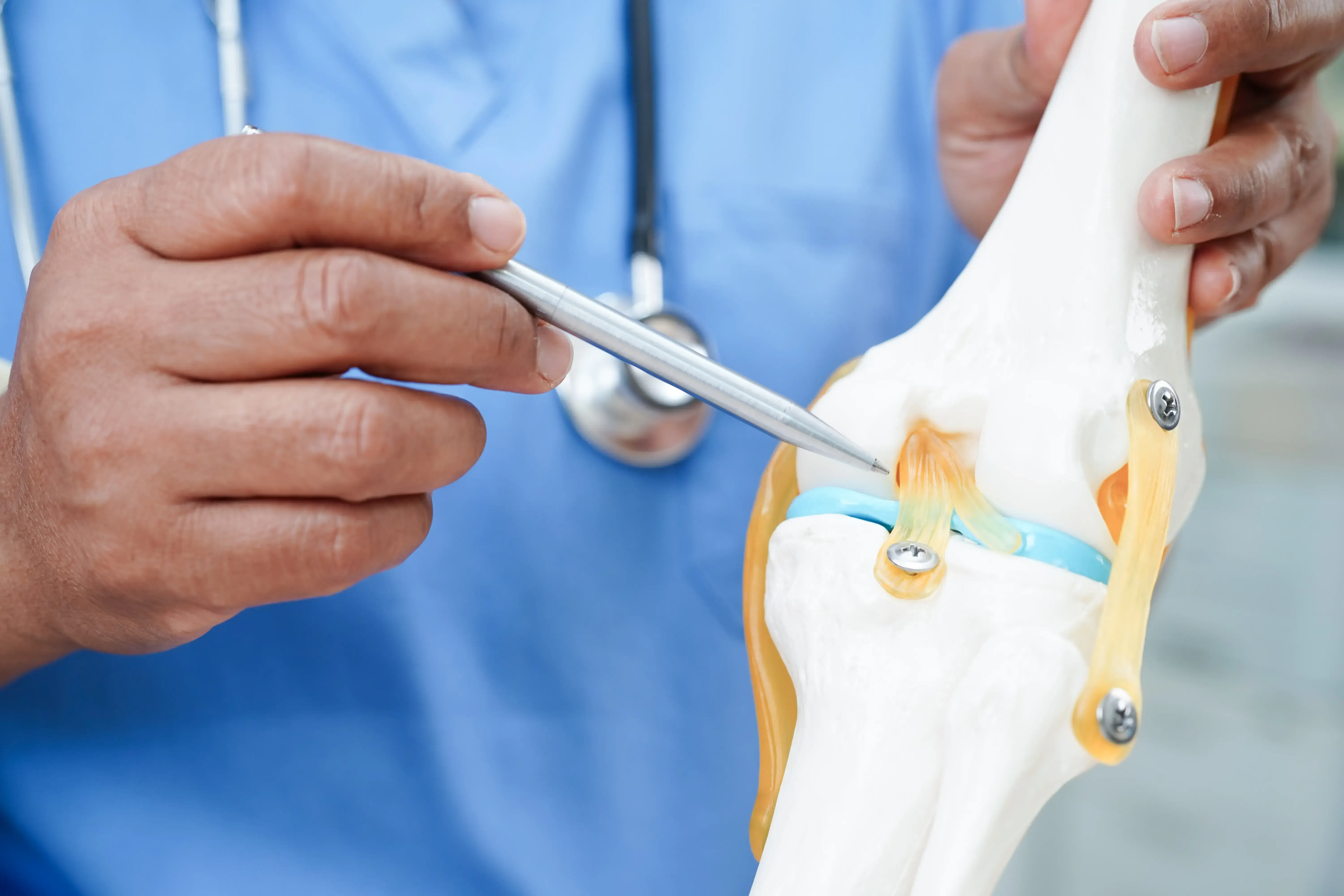 Dr. Leo Chen performing arthroscopic ACL reconstruction in Fort Walton Beach, FL