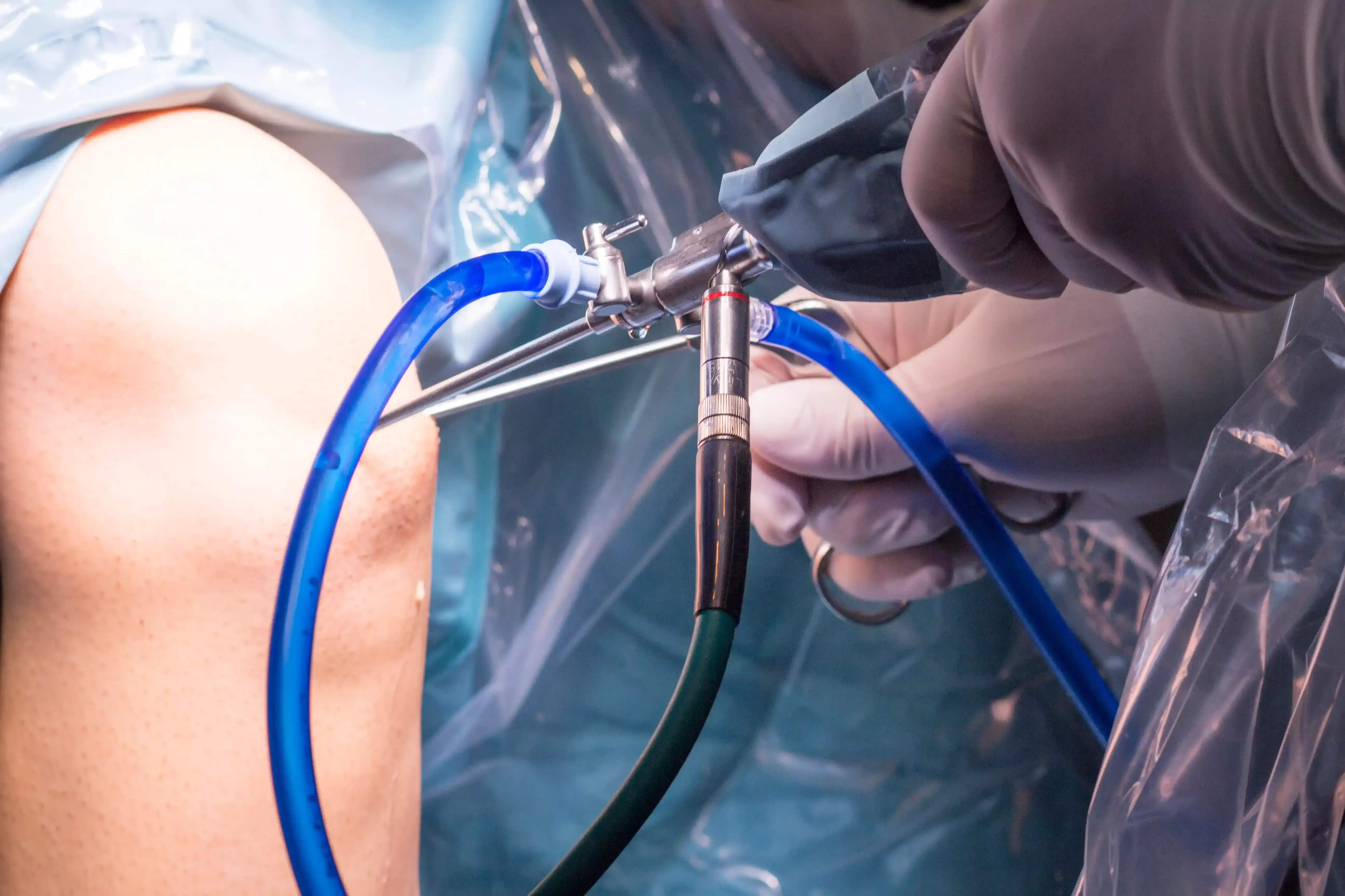 Dr. Leo Chen performing knee arthroscopy at Emerald Coast Ortho in Fort Walton Beach, FL