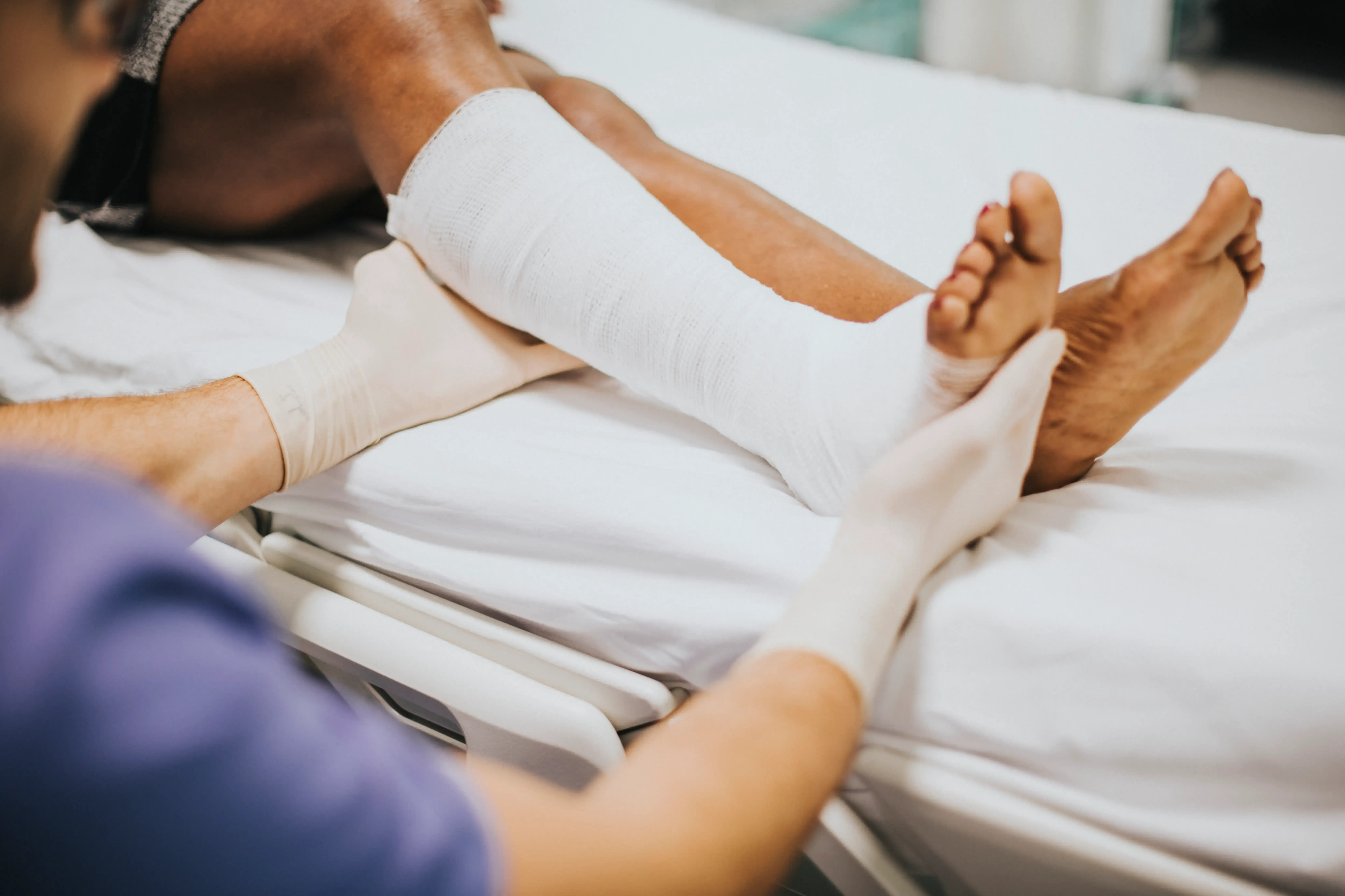 Orthopedic cast application at Emerald Coast Sports Medicine and Orthopedics in Fort Walton Beach FL