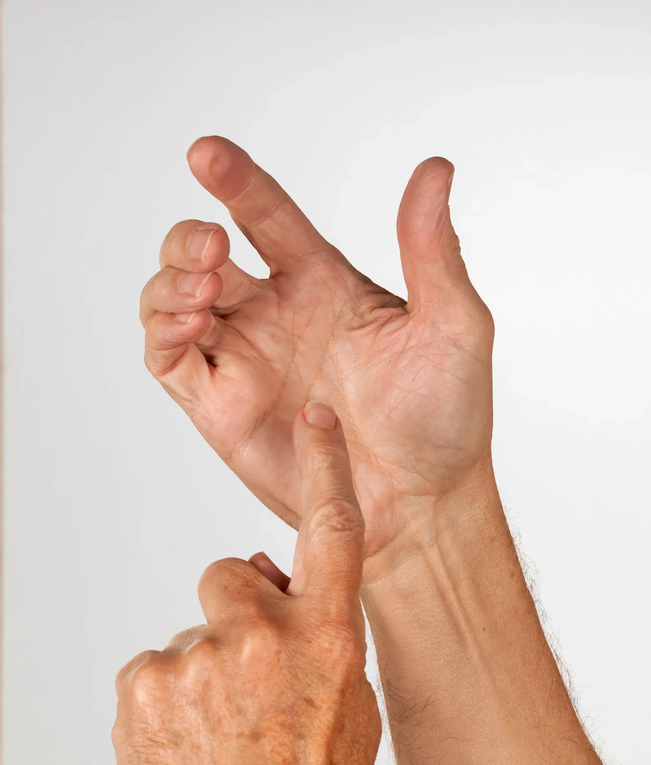 Signs You May Have Trigger Finger